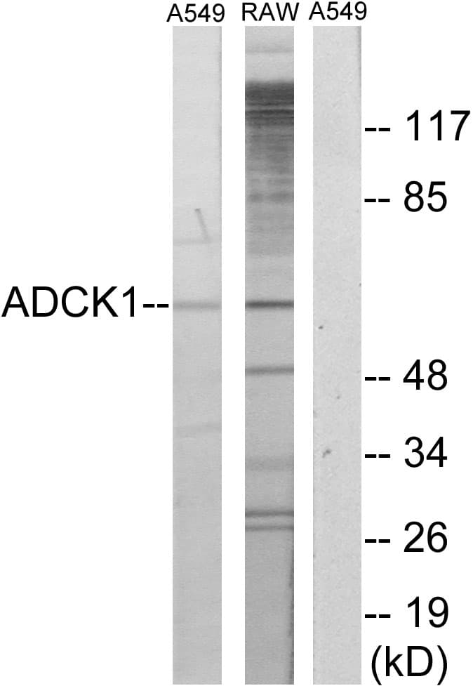 Polyclonal Rabbit anti-Human ADCK1 Antibody (aa251-300, WB)