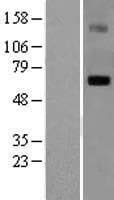 Human LGI1 Protein (Over-Expression Lysate Myc-DDK (Flag))