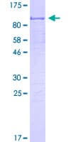 Human CRD-BP / ZBP1 / IGF2BP1 Protein (Recombinant GST)