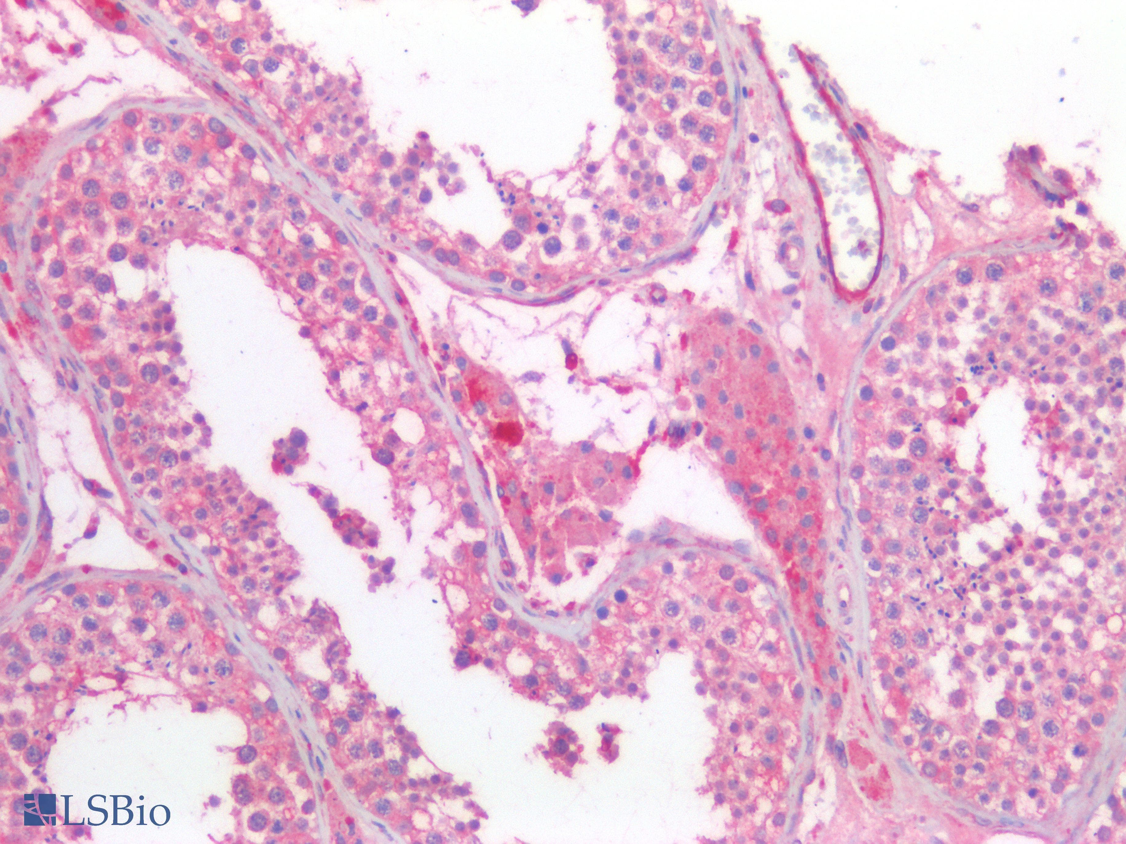 PathPlus™ HEXB Antibody