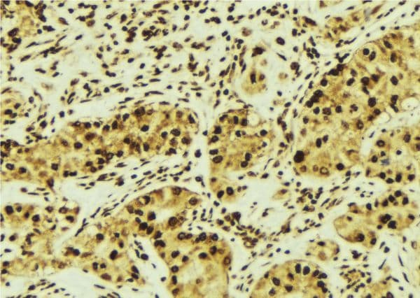 Polyclonal Rabbit anti-Human RASSF1 / RASSF1A Antibody (IHC, WB)