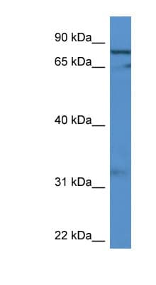 GFM2 Antibody (aa435-484)