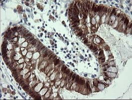 CMPK / CMPK1 Antibody (clone OTI2F5, Carrier-free)