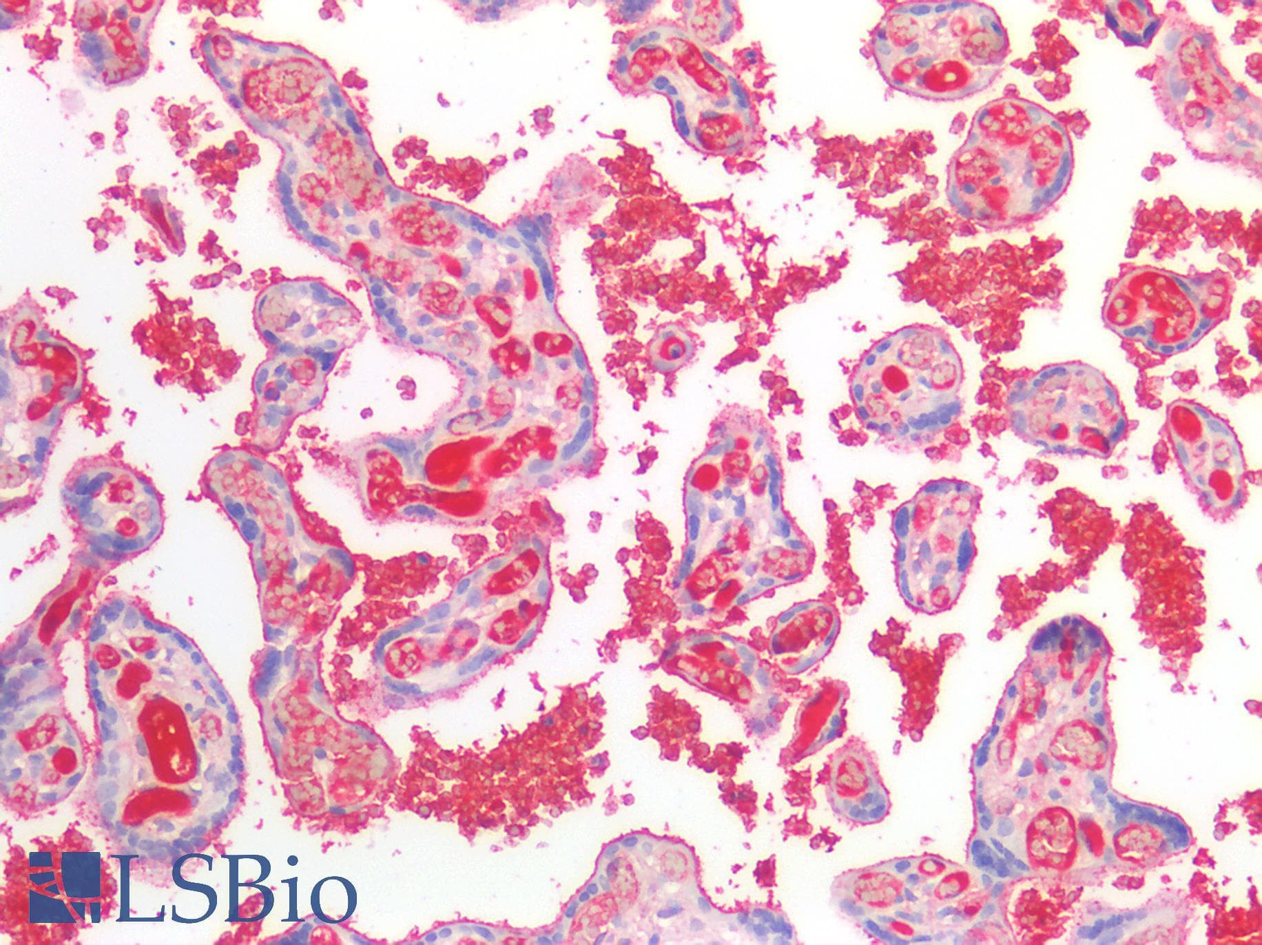 IHC-plus™ Monoclonal Mouse anti-Human FN1 / Fibronectin Antibody (IHC, IF, WB)