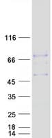 Human SHISA3 Protein (Recombinant Myc-DDK (Flag))