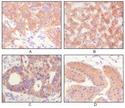 Pan Cytokeratin Antibody (clone 7H8)