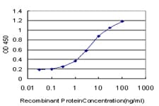 ADAM11 Antibody (clone 3D4)