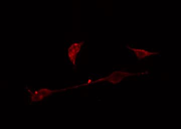 Polyclonal Rabbit anti-Human AGBL4 Antibody (IF, WB)