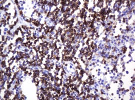 Monoclonal Mouse anti-Human CD2 Antibody (clone OTI3E11, IHC, WB)