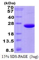 Human CREG / CREG1 Protein (Recombinant His)