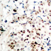 RBBP8 / CTIP Antibody (Internal)