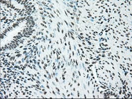 BRAF / B-Raf Antibody (clone OTI4C5)