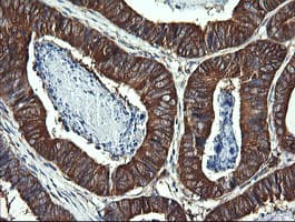 DNM1L / DRP1 Antibody (clone OTI4B5)