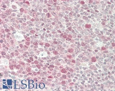 IHC-plus™ HDAC7 Antibody (aa100-149)