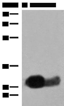HLA-DRB1 Antibody