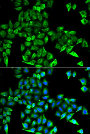 CST3 / Cystatin C Antibody