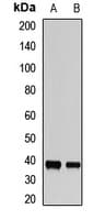 Polyclonal Rabbit anti-Human TOB2 Antibody (IHC, WB)