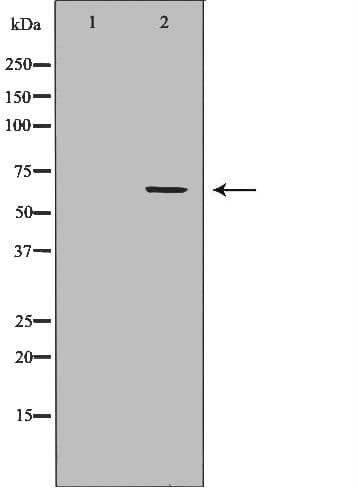 Polyclonal Rabbit anti-Human CDC45 Antibody (IHC, WB)
