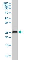 HLA-DMA Antibody (clone 3F12-F11)