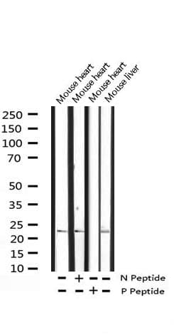 DDIT3 / CHOP Antibody (phospho-Ser30)