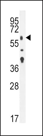 PathPlus™ TGFBR2 Antibody (aa13-40)