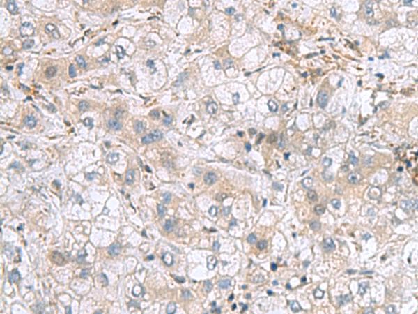 TXNDC12 Antibody