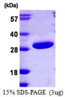 Human PRTFDC1 / HHGP Protein (Recombinant His)