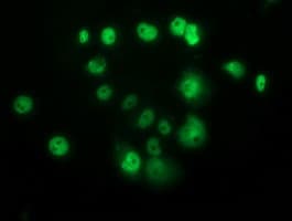 TP53 / p53 Antibody (clone OTI2F7)