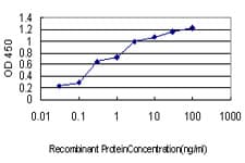 ABCC2 / MRP2 Antibody (clone 1C5)