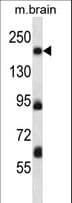 MAP4K4 Antibody (aa506-534)