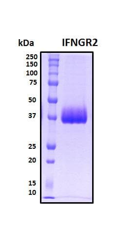 Human IFNGR2 Protein (Recombinant His, N-Terminal)