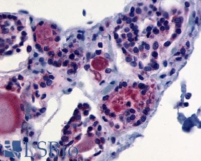 PathPlus™ Polyclonal Rabbit anti-Human TSH Receptor / TSHR Antibody (C-Terminus, IHC)