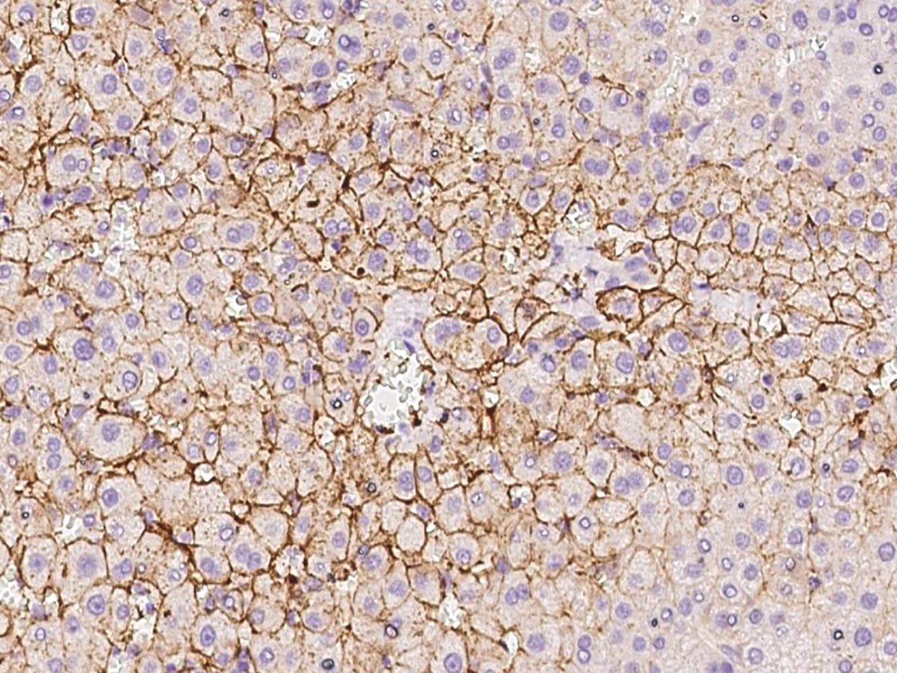 Polyclonal Rabbit anti-Human SLCO1B3 / OATP8 Antibody (IHC)