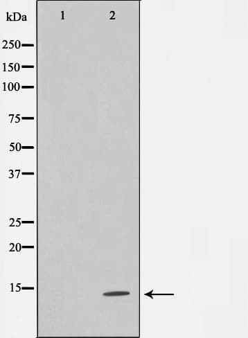 TUSC2 / FUS1 Antibody