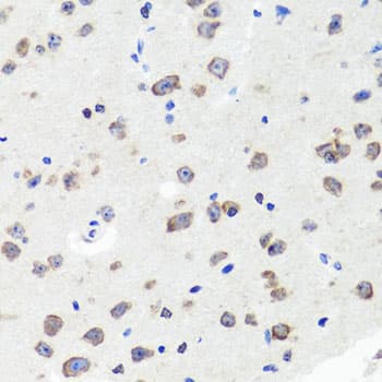 Polyclonal Rabbit anti-Human DLG1 / SAP97 Antibody (IHC, WB)