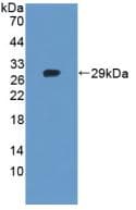 TANK2 / TNKS2 Antibody (PE)