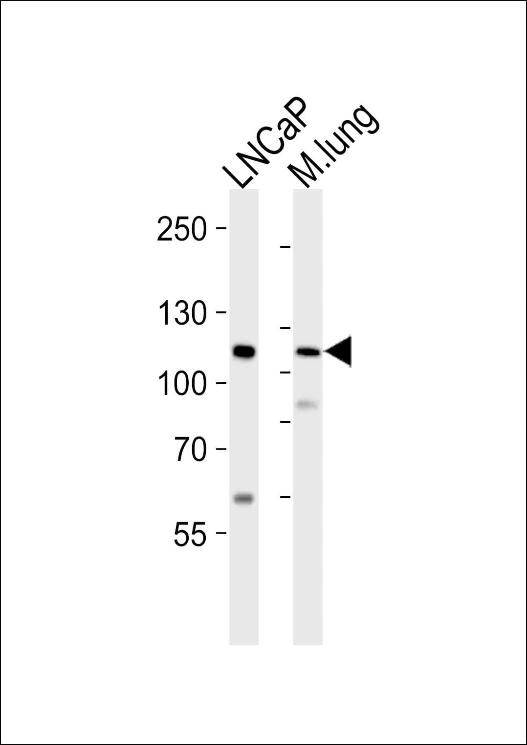 Polyclonal Rabbit anti-Human PRDM16 Antibody (aa771-804, WB)