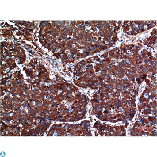 AKT1 Antibody