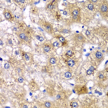 Polyclonal Rabbit anti-Human AMY2A / Pancreatic Amylase Antibody (IHC, WB)