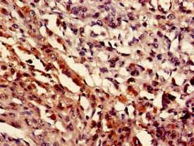 Polyclonal Rabbit anti-Human MEF2D Antibody (IHC, WB)