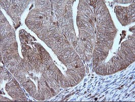 MAP2K1 / MKK1 / MEK1 Antibody (clone OTI3H3)