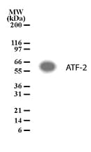 ATF2 Antibody (aa13-27)