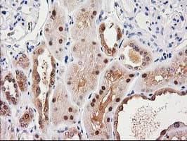 SULT1C2 / Sulfotransferase 1C2 Antibody (clone OTI8A1)