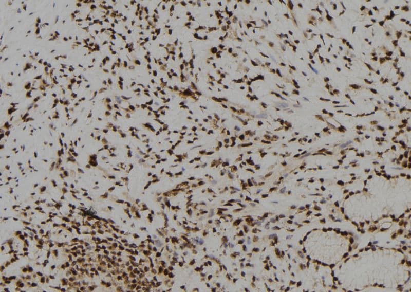 Polyclonal Rabbit anti-Human BNC1 / Basonuclin Antibody (IHC, WB)