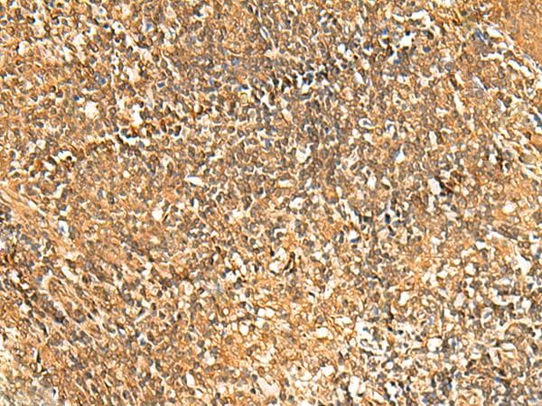 GSG1L Antibody