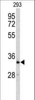 CRELD2 Antibody (aa325-353)