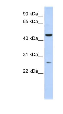 AK9 / AKD1 / AKD2 Antibody (aa144-193)