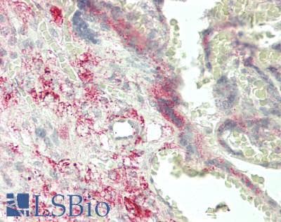 IHC-plus™ Polyclonal Rabbit anti-Human ALDP / ABCD1 Antibody (IHC, WB)