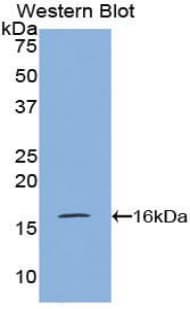 VPREB1 / CD179A Antibody (aa26-134)