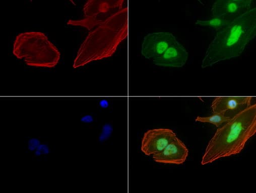 Monoclonal Mouse anti-Human JUN / c-Jun Antibody (clone UMAB49, IHC, IF, WB)